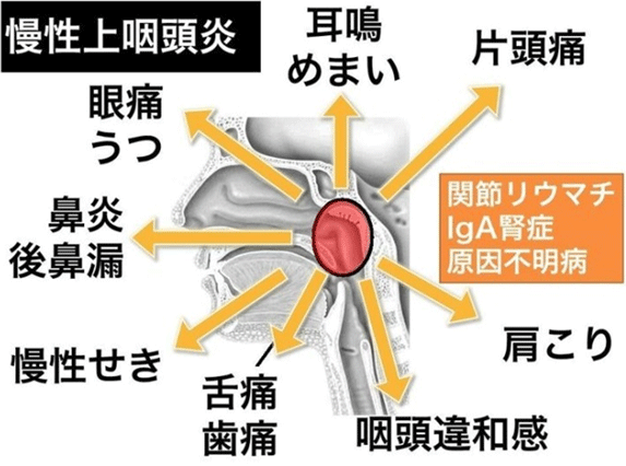 病気になると勃起不全を引き起こす可能性があります